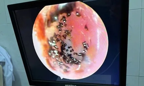 Bé 9 tuổi tai bị ngứa và chảy máu, đi khám phát hiện điều đáng sợ
