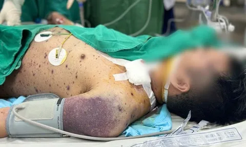 Hai nam thanh niên rơi vào nguy kịch vì biến chứng thủy đậu