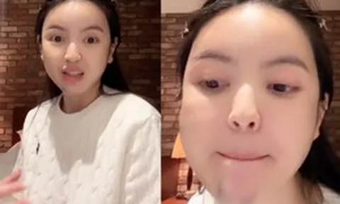 Chu Thanh Huyền kể lại trải nghiệm kinh hoàng khi đi xử lý hậu quả phẫu thuật thẩm mỹ
