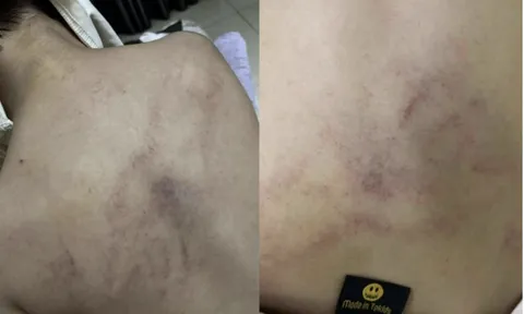 Đình chỉ cô giáo bị tố dốc ngược đầu trẻ, ném xuống giường ở Trường Mầm non Gia Thụy