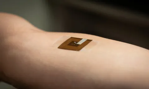 Độc đáo miếng dán phát hiện ung thư da