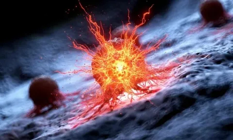 Các nhà nghiên cứu Mỹ tìm thấy “tử huyệt” của ung thư