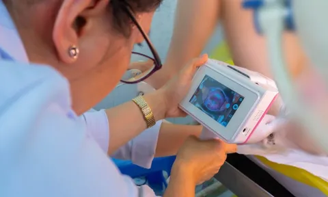 AI tầm soát ung thư cổ tử cung ở Bệnh viện Hùng Vương, 5 phút nhận kết quả