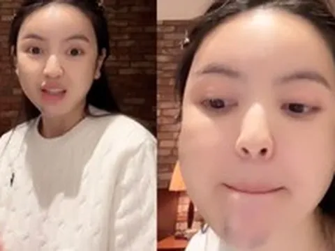 Chu Thanh Huyền kể lại trải nghiệm kinh hoàng khi đi xử lý hậu quả phẫu thuật thẩm mỹ