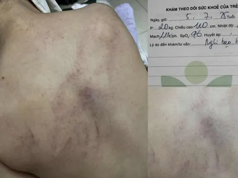 Vụ cháu bé 4 tuổi bị đánh, ném vào tường ở Hà Nội: Cô giáo bạo hành nói gì?