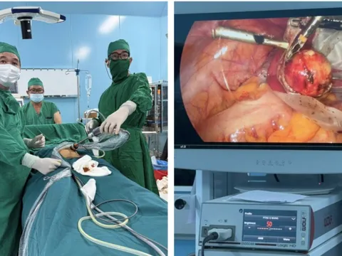 Bóc khối u có chứa da, tóc cho nữ bệnh nhân ở Côn Đảo
