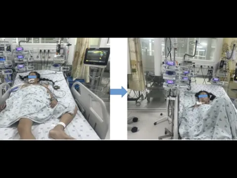 Bé gái ở An Giang mắc căn bệnh hiếm, với chưa đến 12 ca ở trẻ em được báo cáo trên y văn thế giới