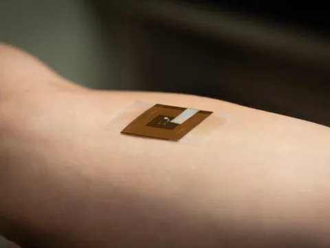 Độc đáo miếng dán phát hiện ung thư da