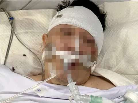 Luật sư lên tiếng vụ người đàn ông nguy kịch khi xe tông trúng chó chạy rông