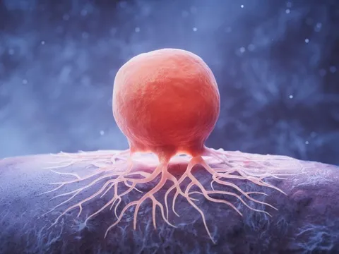 Tìm ra loại thuốc đầu tiên chống được "RNA bất tử" của ung thư