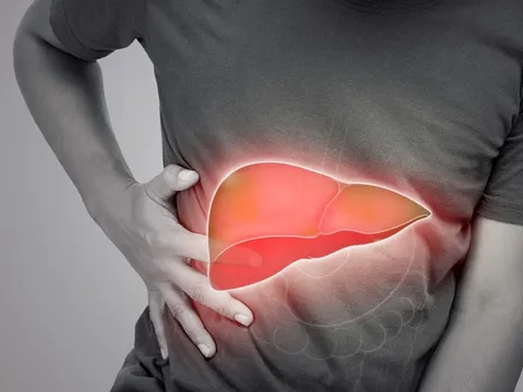 Mắc bệnh gan nhiễm mỡ vì thứ tưởng rằng "lành mạnh"