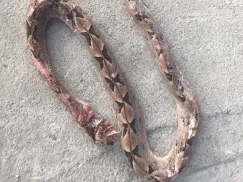 Người đàn ông 27 tuổi suýt mất mạng vì tự ý chữa bệnh theo “kiểu lạ đời"