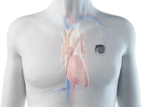 Chàng trai ở TPHCM mắc bệnh hiếm, 100.000 người chỉ có 2 người mắc