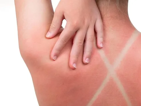 Điều tưởng bình thường này có thể kích hoạt “chuỗi phản ứng ung thư”